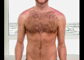 Brody Fields