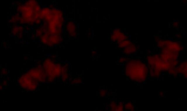 MACK PARENT SMASHING TASTEY CULO BOTTOM MYSTERIO