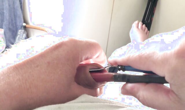 Foreskin With Pliers And Highlighter