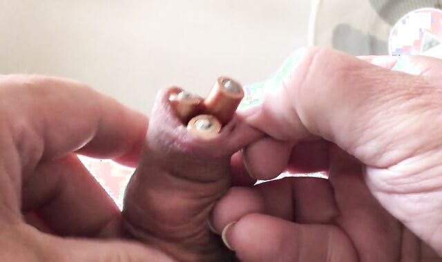 Batteries In Foreskin - two Of three