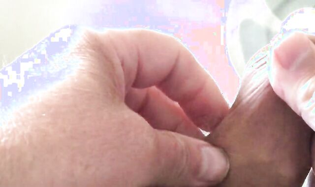 Batteries In Foreskin - two Of three