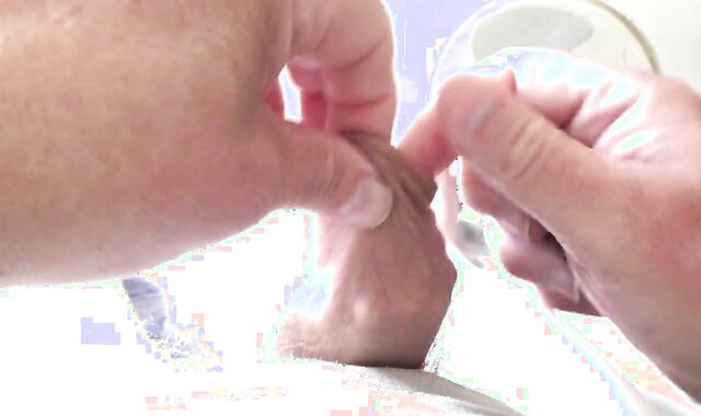 Batteries In Foreskin - two Of three