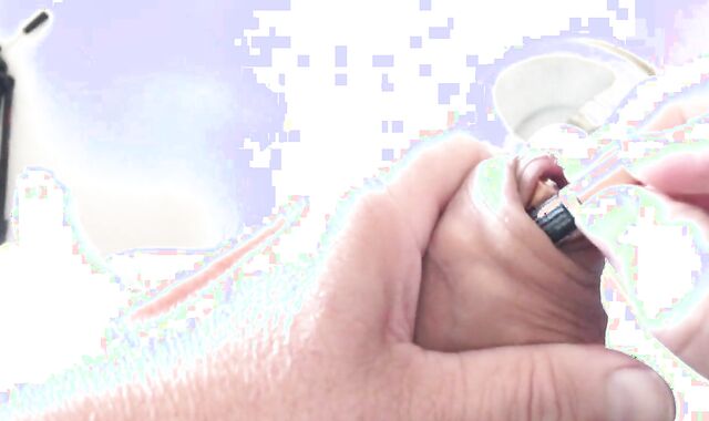 Batteries In Foreskin - two Of three