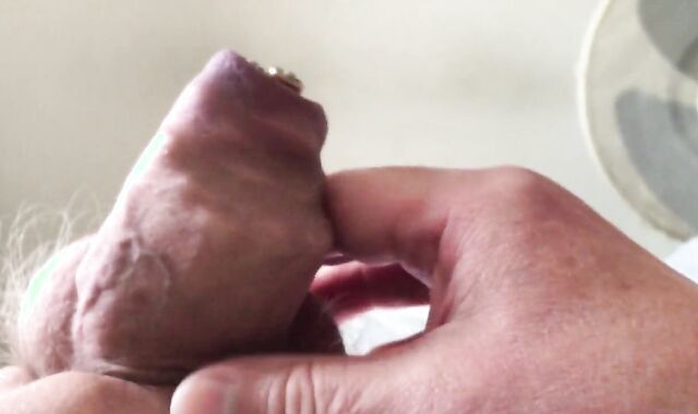 Batteries In Foreskin - two Of three