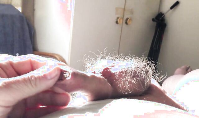 Batteries In Foreskin - 1 Of 3