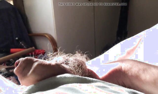 Batteries In Foreskin - 1 Of 3