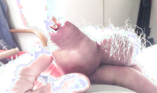 Batteries In Foreskin - 1 Of 3