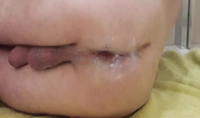 Blossom , Buttplug And Didlo