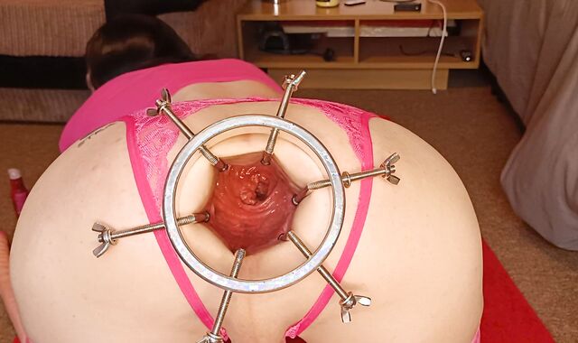 Losing My Marbles Ft David Anderson