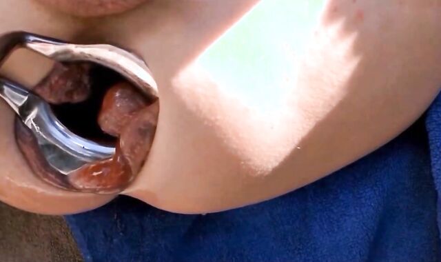 Extreme Anal Fisting for My Loose Sloppy Asshole