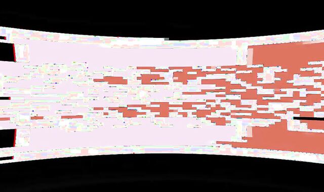 DoctorTapes:spycam The Secret of Chronic Tiredness Solved