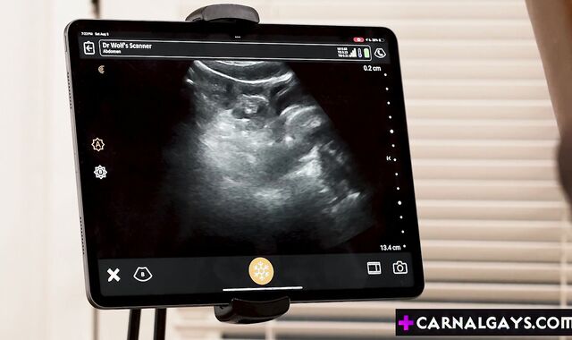 ULTRA SOUND ANAL! Black twink anal fucked!